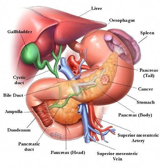 Pancreatic Cancer: Symptoms, Causes and Treatment